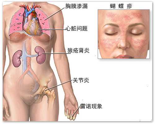无锡试管助孕：代生包男孩的费用及相关考量